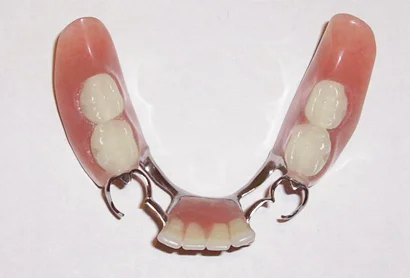 Partial Dentures -Stadium Family Dentistry